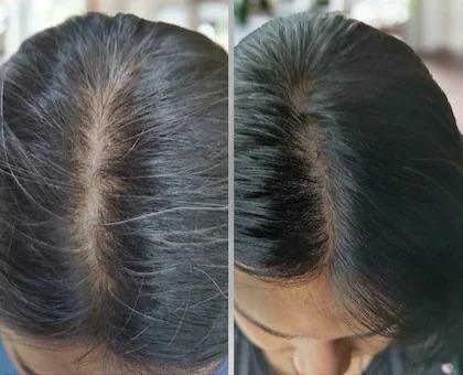 Black Gold Hair Oil  - 100% Working 🌿