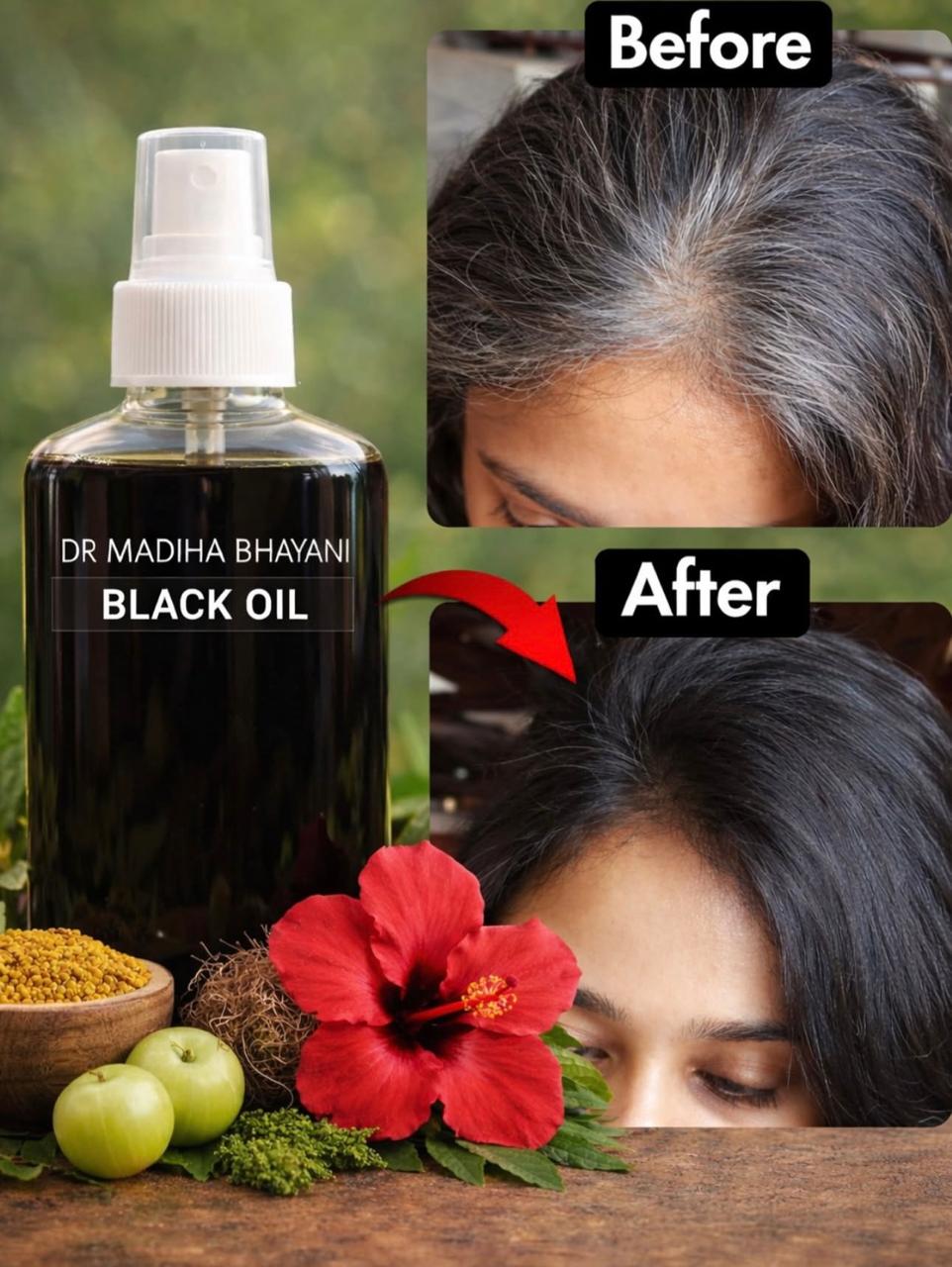 Black Gold Hair Oil  - 100% Working 🌿