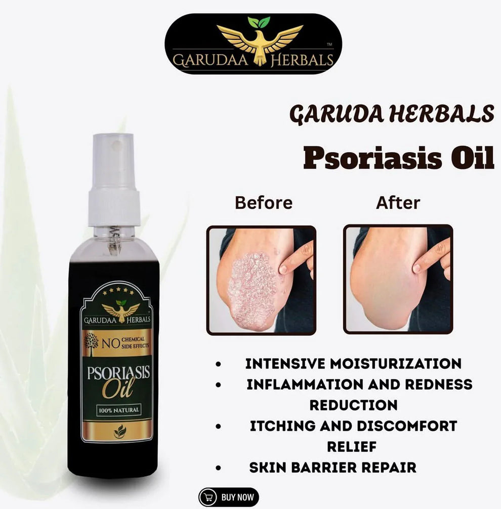 Garuda Herbal Psoriasis Oil-Advanced Psoriasis Clearing Oil